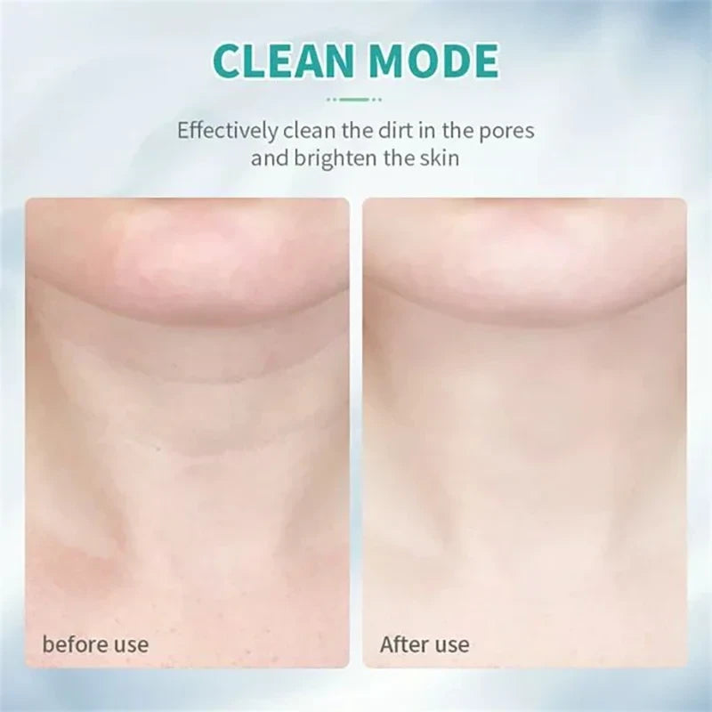 Neck Face Lift Beauty Device